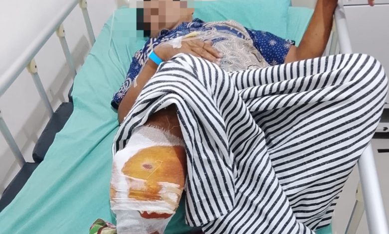 Petani Karet OKU Diduga Diserang Beruang, Alami Luka Serius 