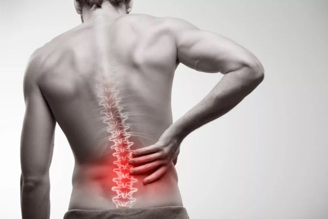 Bahaya Osteoporosis Yang Sering Tidak Disadari