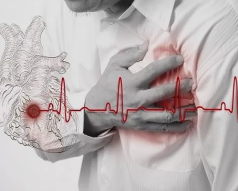 5 Penyakit Berbahaya Akibat Kolesterol Tinggi yang Perlu Diwaspadai Setelah Lebaran