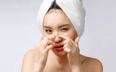 Tips Ampuh dan Aman untuk Mengusir Komedo di Hidung