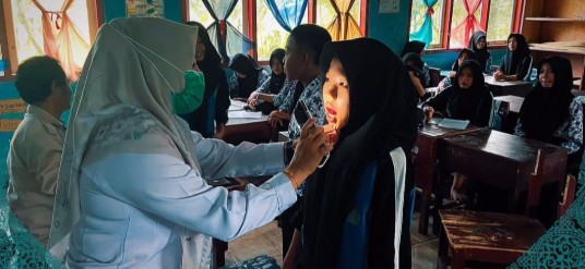 Deteksi Dini Gangguan Kesehatan, Puskesmas Buay Pemaca Periksa Siswa