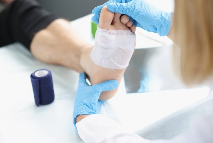 Tak Bisa Sembarangan, Begini Cara Tepat Merawat Luka pada Penderita Diabetes