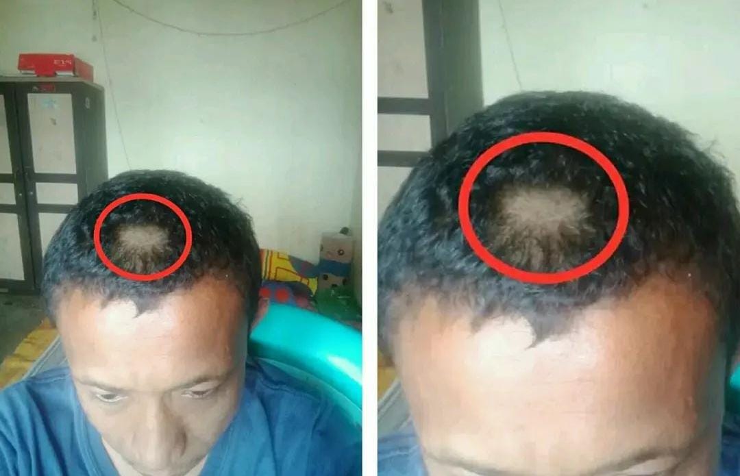 Rambut Digunting, Ortu Balas Dendam Gunting Balik Rambut Guru Anaknya