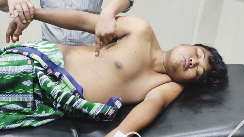 Gagal Maling, Lapor Polisi Jadi Korban Begal
