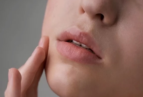 Bibir Pecah-Pecah Saat Puasa: Penyebab, Dampak, dan Cara Mengatasinya