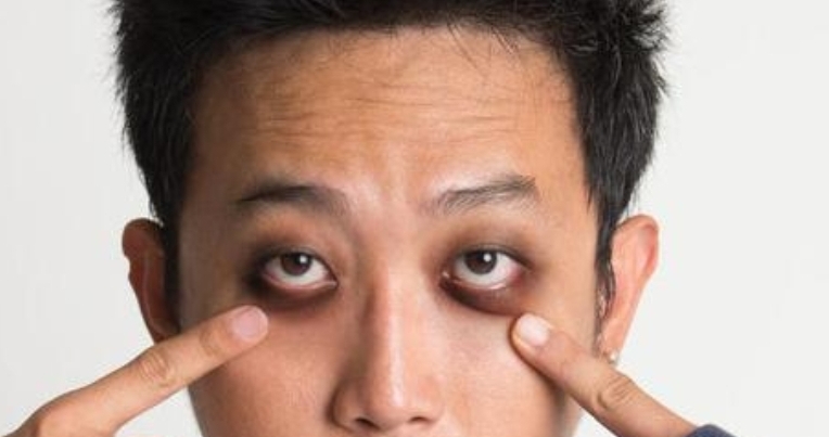 Eye Cream Viral Cocok Atasi Mata Panda dan Penuaan