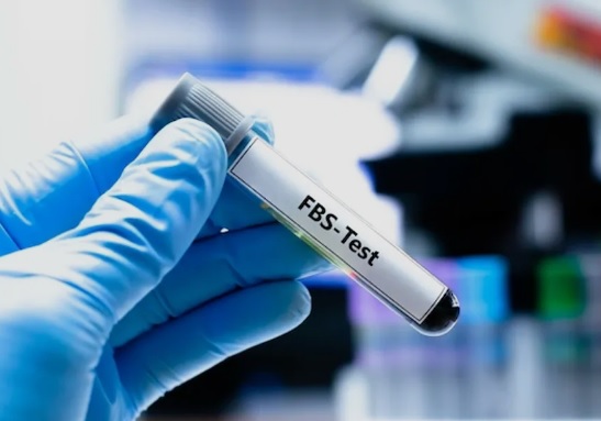 Jangan Salah Persiapan! Ini Tes Laboratorium yang Wajib Puasa