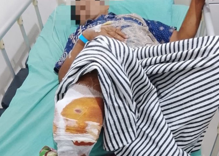 Petani Karet OKU Diduga Diserang Beruang, Alami Luka Serius 