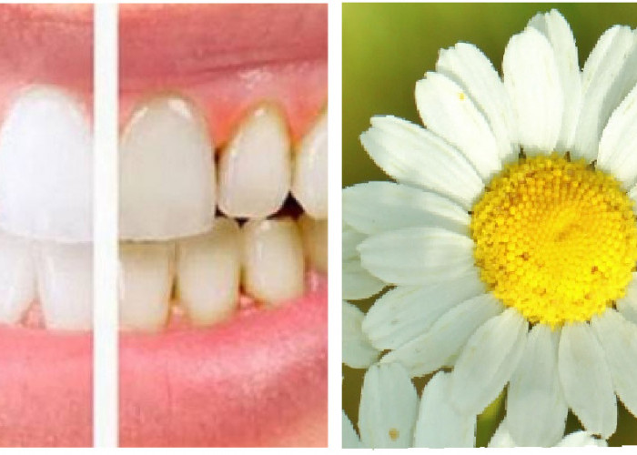 Plak Hilang Gigi Putih Hanya dengan Tanaman Chamomile, Bisa Dibuat Sendiri Loh!