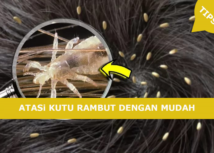 MUDAH SEKALI! Basmi Kutu Rambut sampai ke Telurnya, Hanya Pakai Bahan Dapur saja?