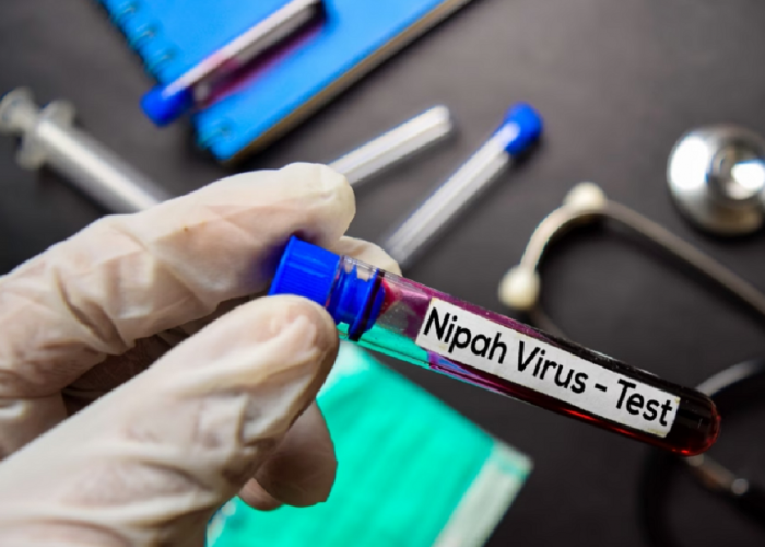  Virus Nipah terdeteksi di Indonesia? Menyusul Temuan Lima Kasus di Negara 