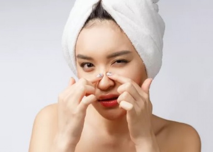 Tips Ampuh dan Aman untuk Mengusir Komedo di Hidung