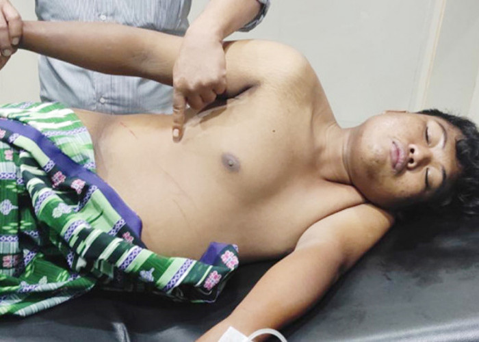 Gagal Maling, Lapor Polisi Jadi Korban Begal