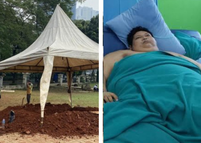 Fajri Lelaki Bobot 300 Kilogram Meninggal dunia, Kenali Obesitas ada yang pernah Berhasil Sembuh
