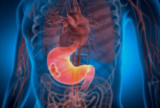 Sering Dikira Maag, Ternyata Bisa Jadi Kanker Lambung