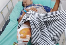 Petani Karet OKU Diduga Diserang Beruang, Alami Luka Serius 