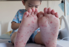 Jangan Anggap Sepele! Ini 5 Cara Lindungi Anak dari Flu Singapura