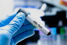 Jangan Salah Persiapan! Ini Tes Laboratorium yang Wajib Puasa